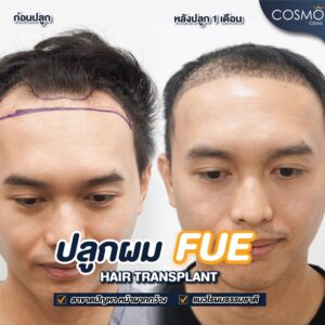 แนวไรผม