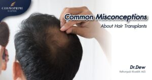 Common Misconceptions About Hair Transplants