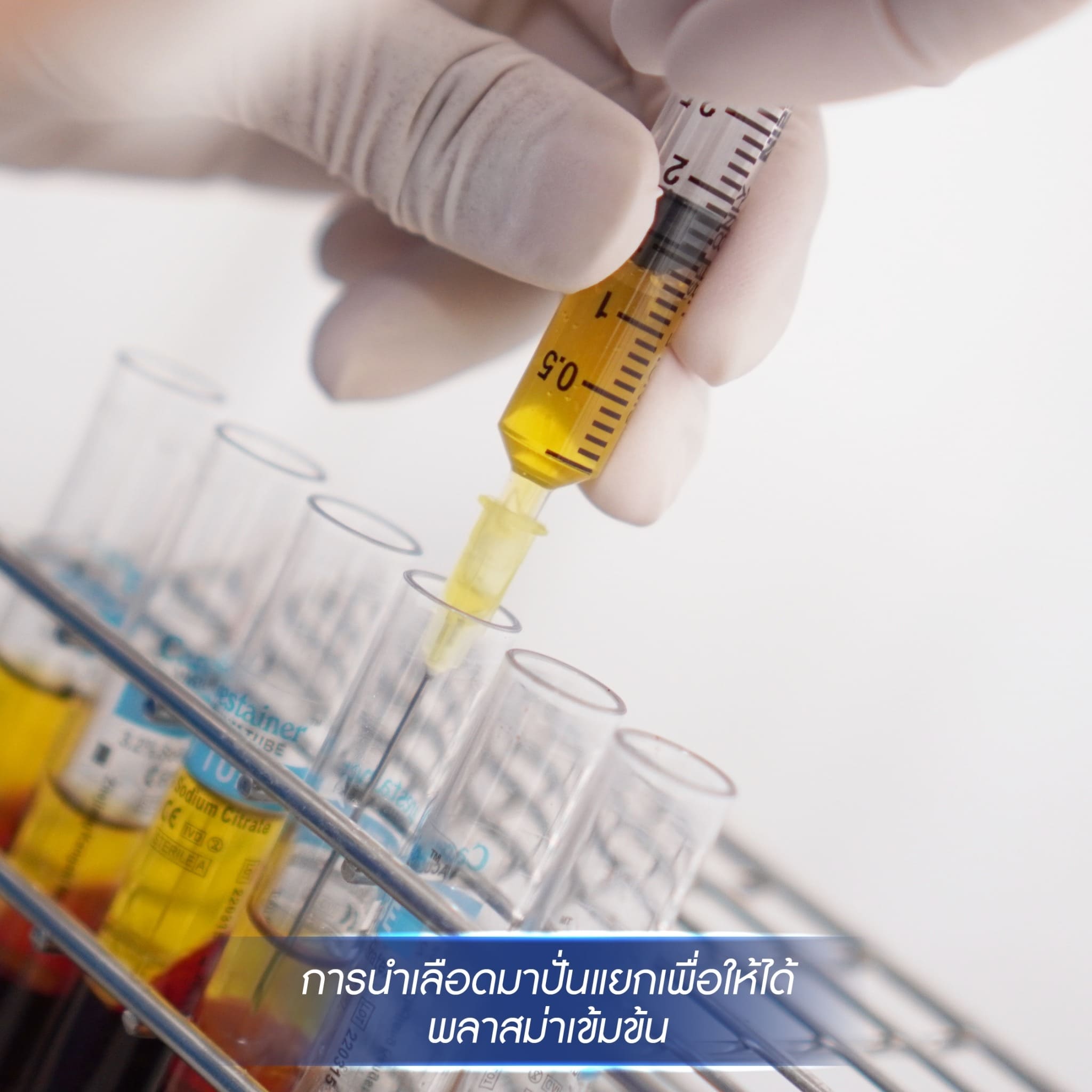 PRP uses your own blood