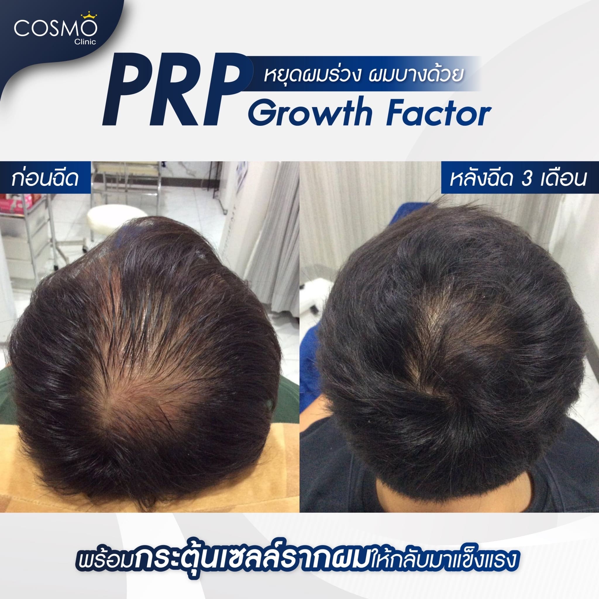 PRP in Bangkok