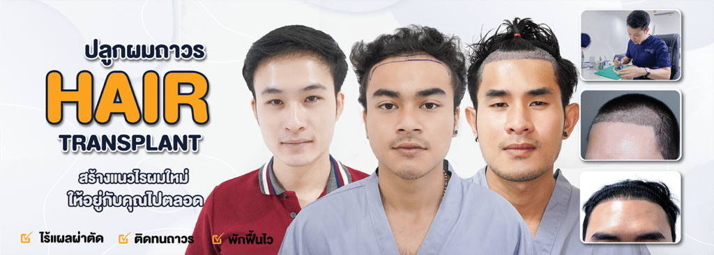 Hair transplant