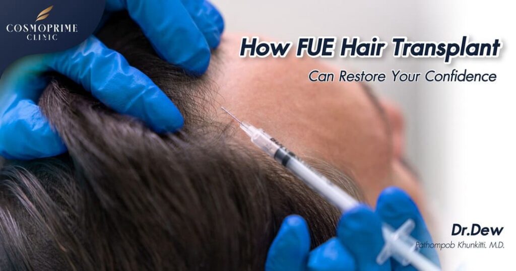 How FUE Hair Transplant Can Restore Your Confidence