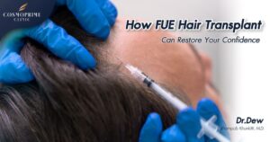 How FUE Hair Transplant Can Restore Your Confidence