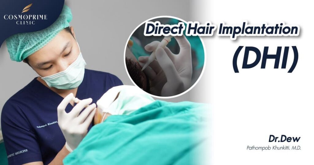 Direct Hair Implantation