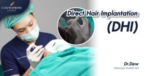 Direct Hair Implantation
