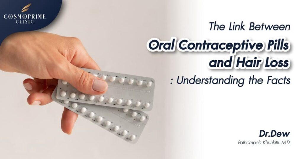 Oral Contraceptive Pills and Hair Loss