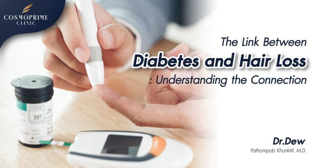 Link Between Diabetes and Hair Loss