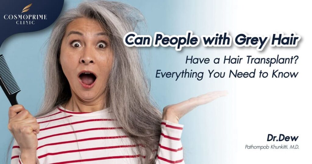 Grey Hair Have a Hair Transplant