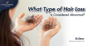 What Type of Hair Loss Is Considered Abnormal?