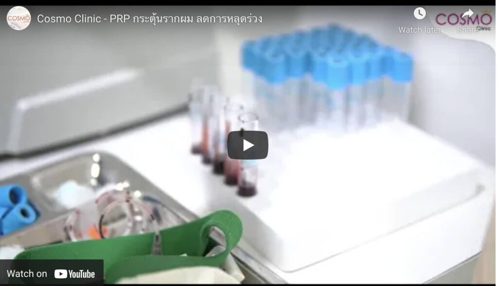 PRP
