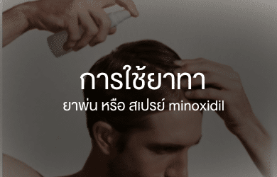 minoxidil