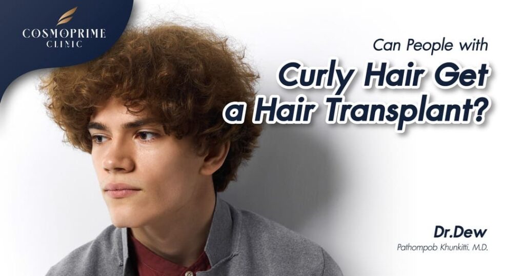 Can People with Curly Hair Get a Hair Transplant?