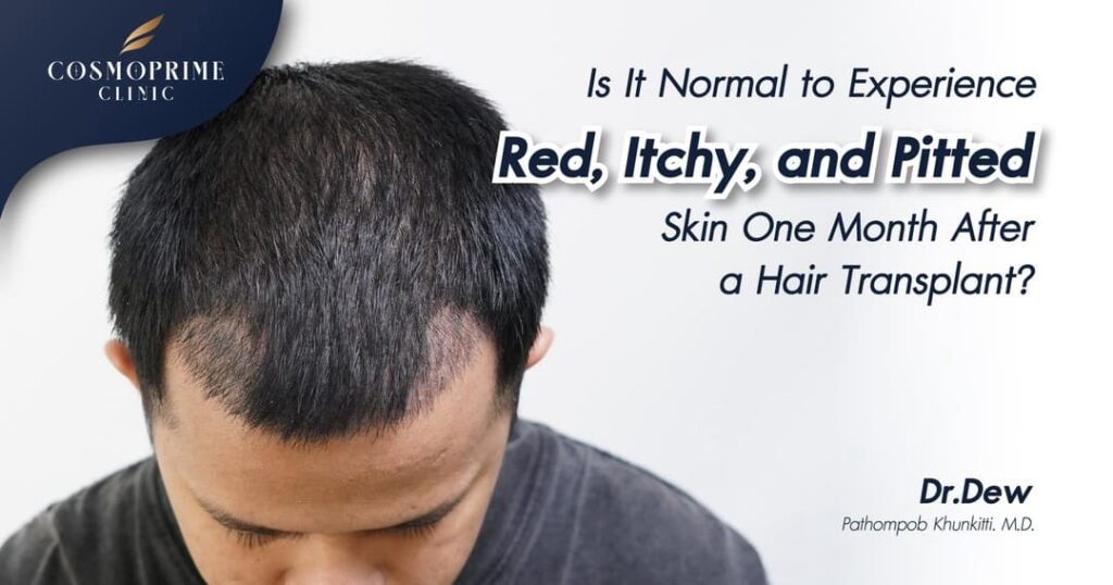 Red, Itchy, and Pitted Skin