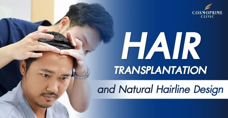 Natural Hairline