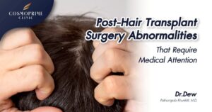 Post-Hair Transplant Surgery Abnormalities