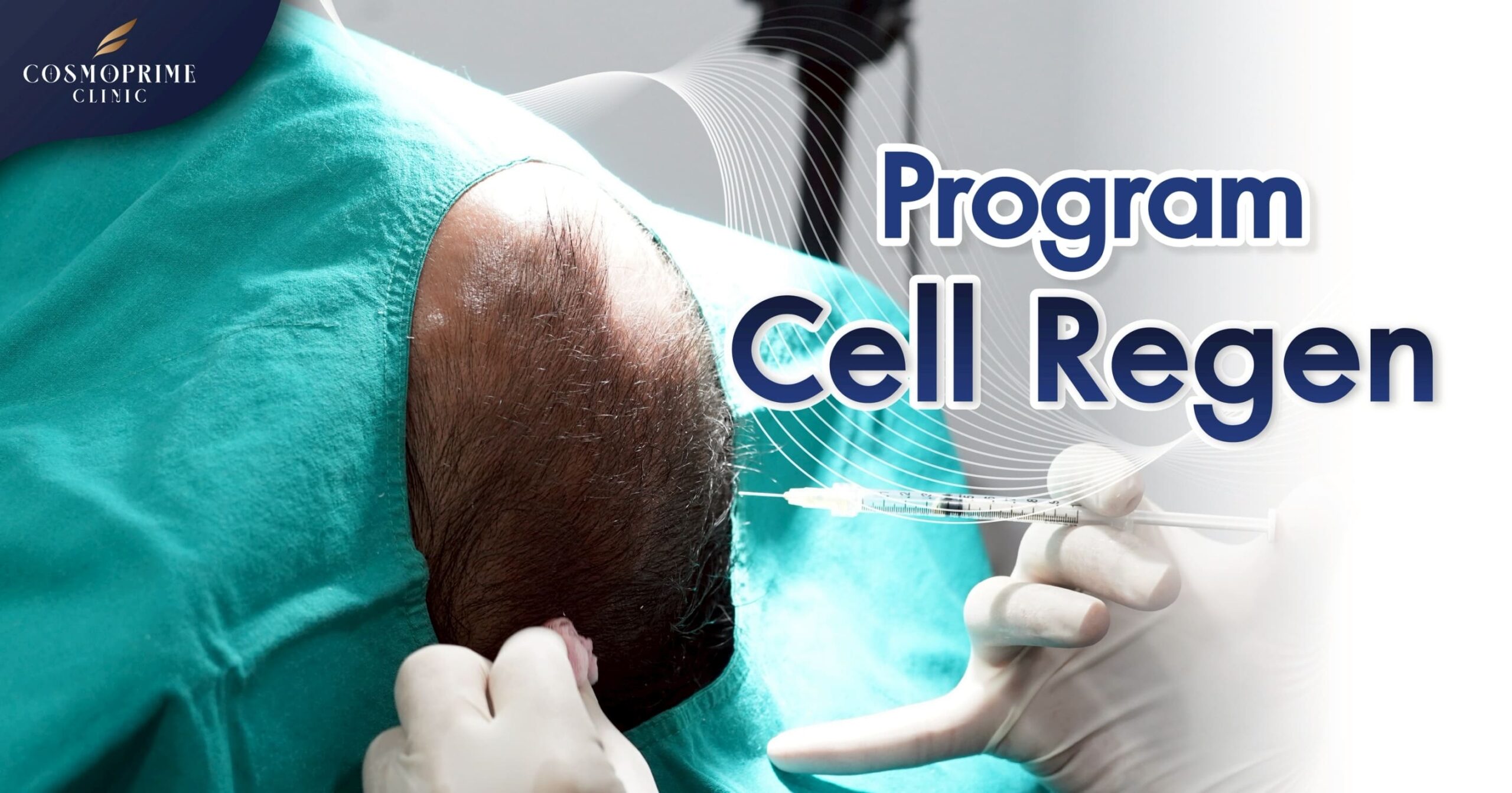 non surgical hairtransplant