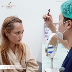 long hair transplant consultation