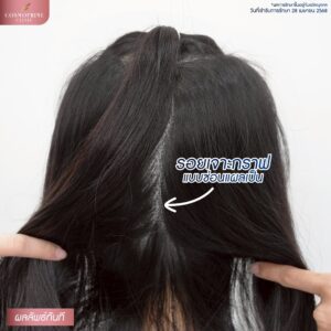 long hair transplant scar