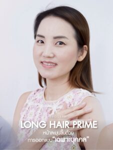 Female long hair transplant natural hairline result