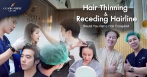 Hair Thinning