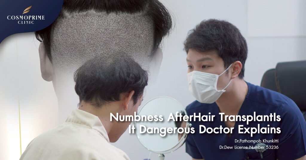 Numbness After Hair Transplant
