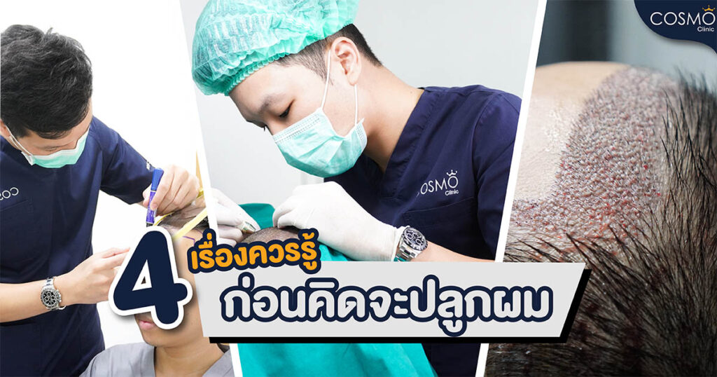 เรื่องน่ารู้ก่อนปลูกผม