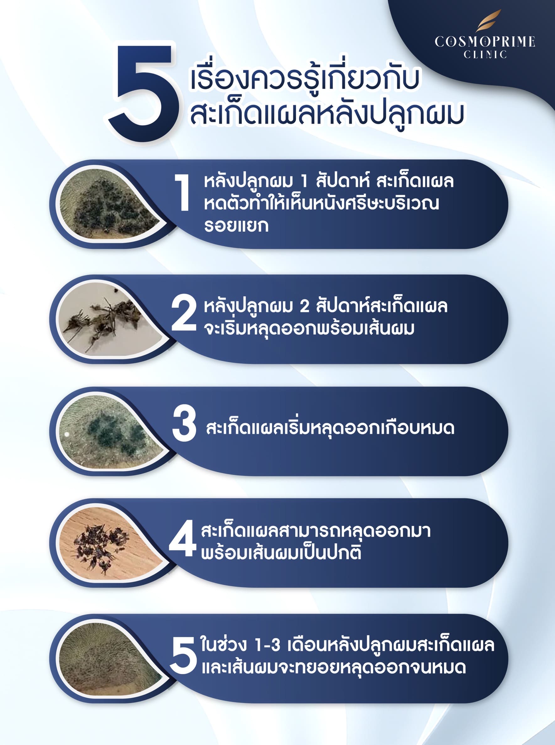 สะเก็ดแผลหลังปลูกผม