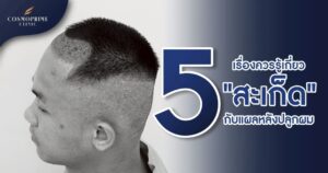 สะเก็ดแผลหลังปลูกผม