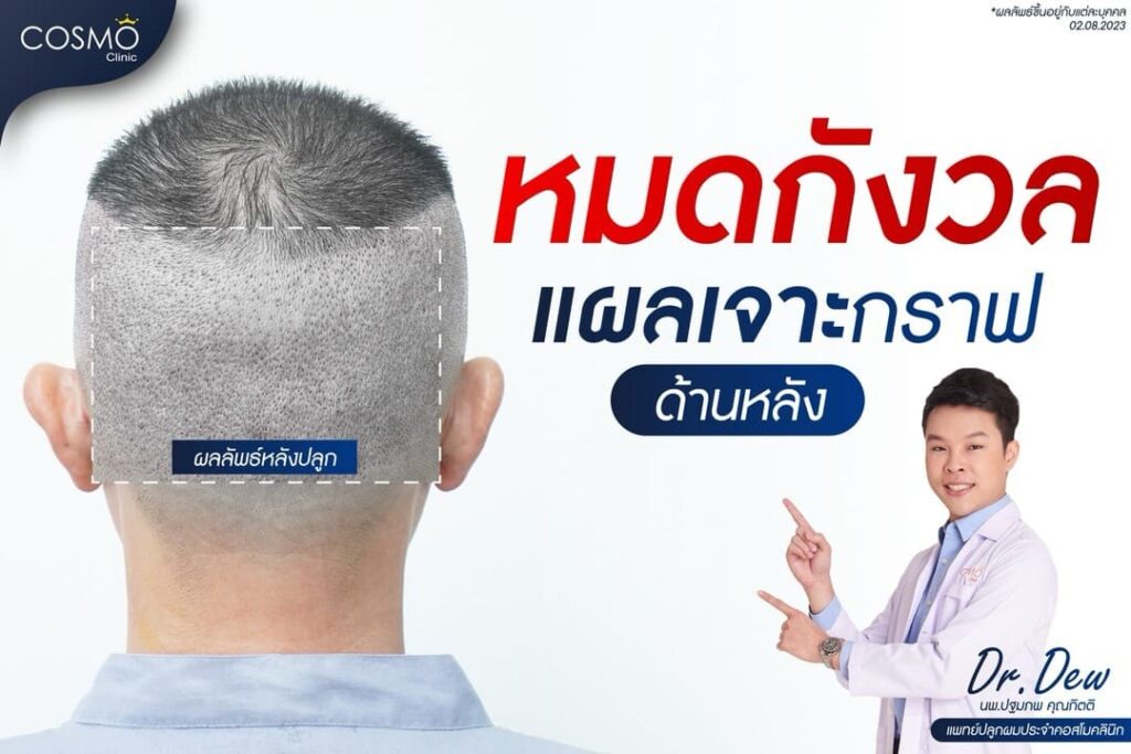 แผลเจาะกราฟ