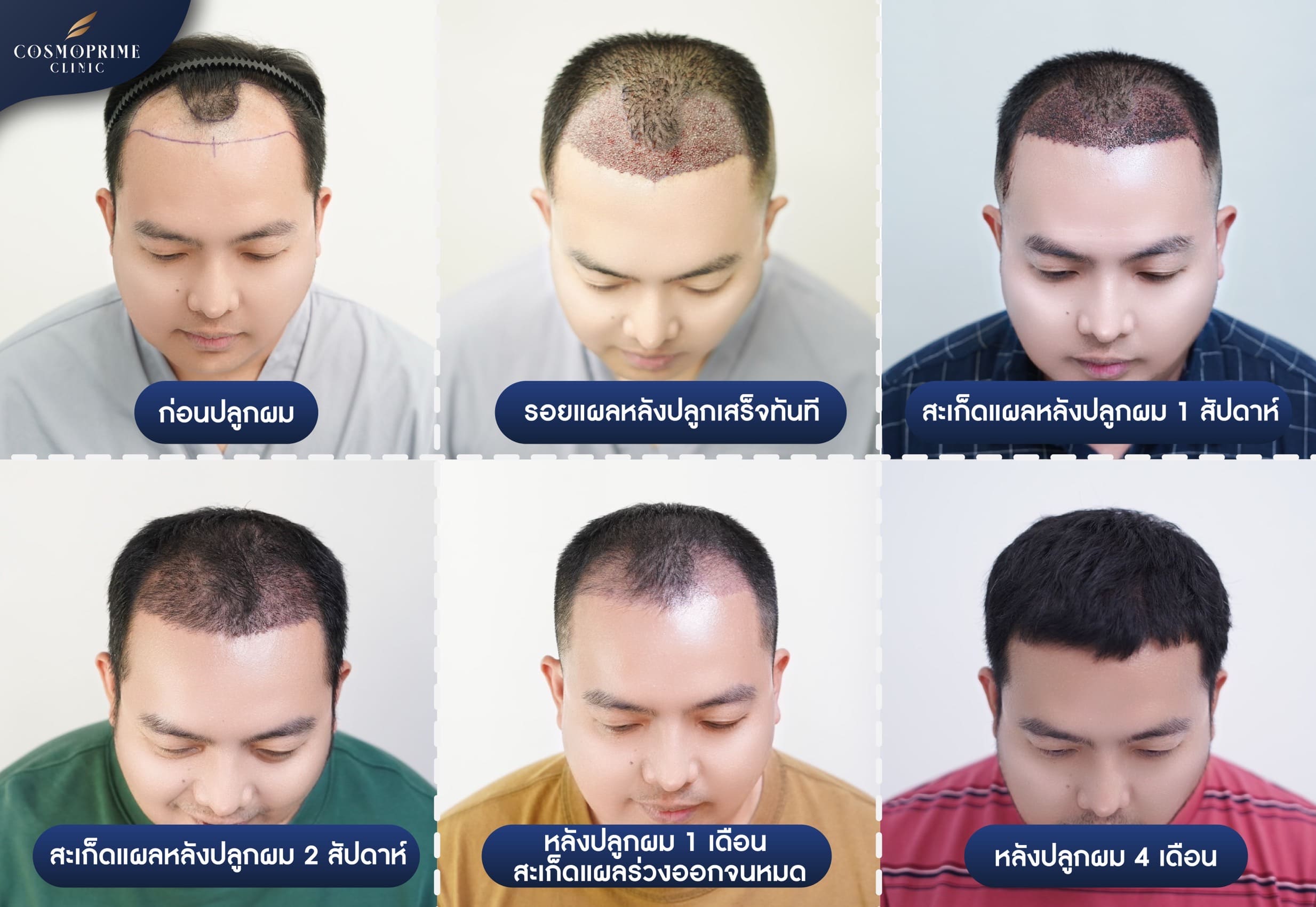 ผมขึ้น