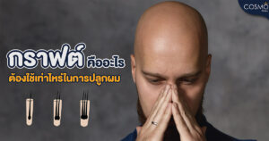 กราฟต์ผมคือ