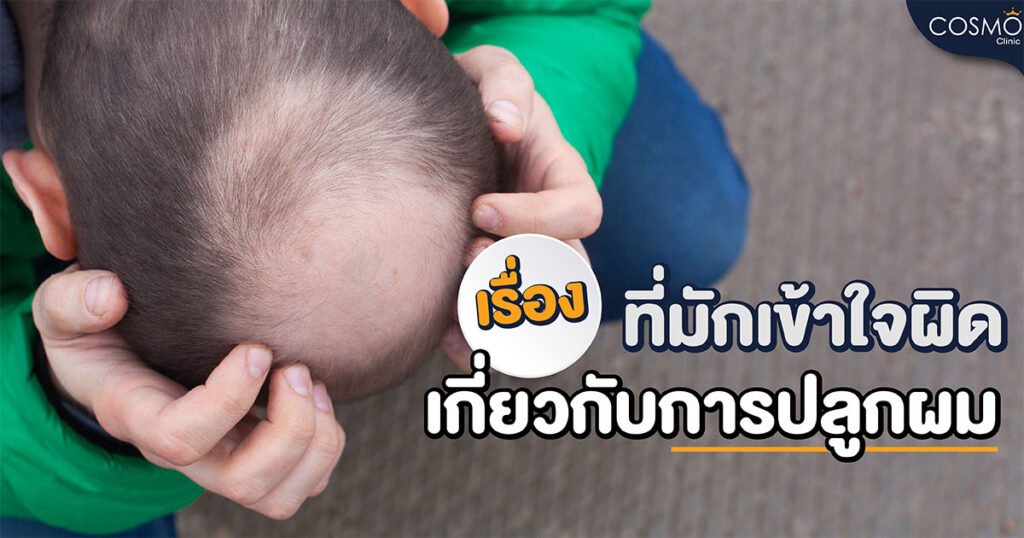 เรื่องที่มักเข้าใจผิดเกี่ยวกับปลูกผม