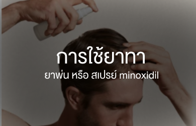 minoxidil