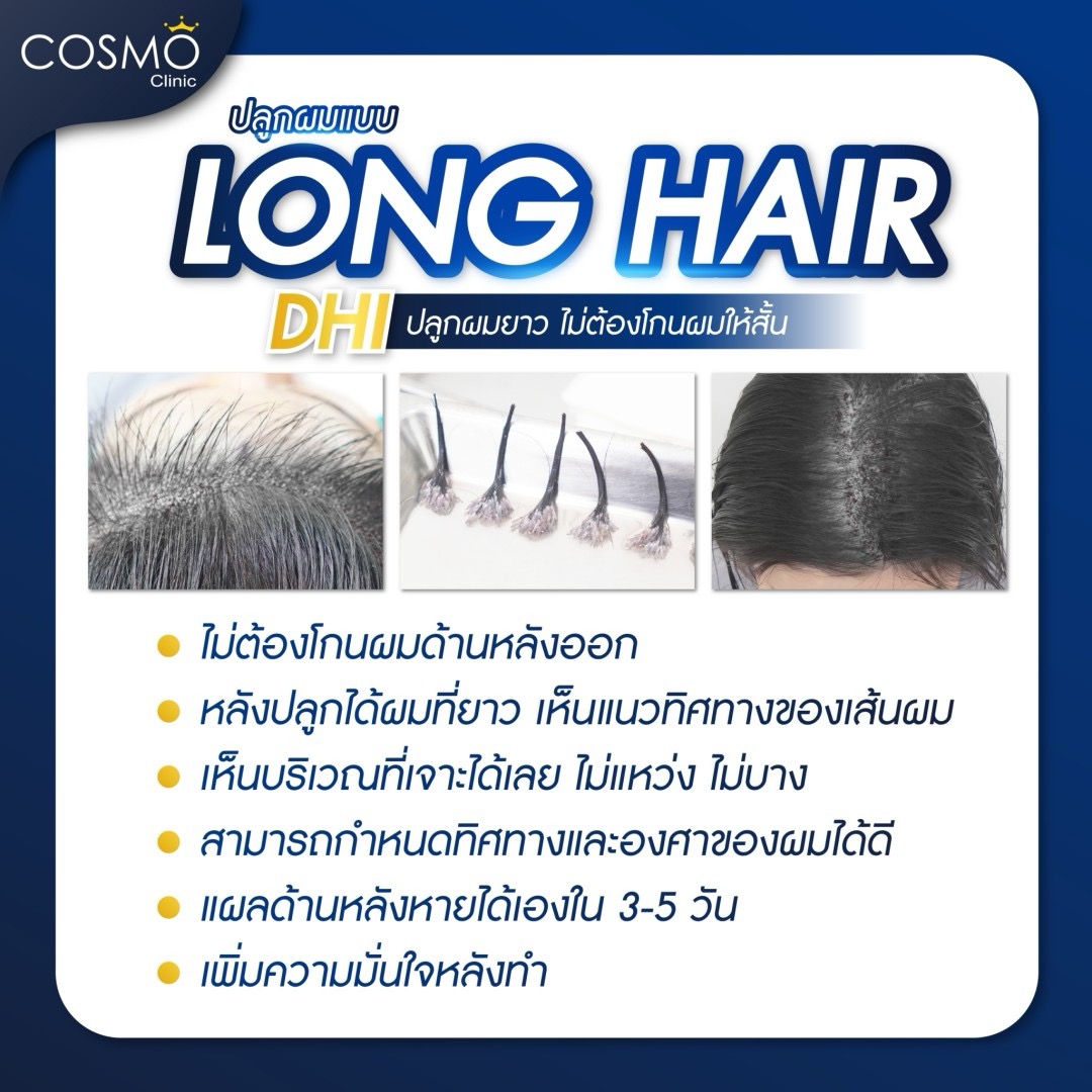 ปลูกผมยาว