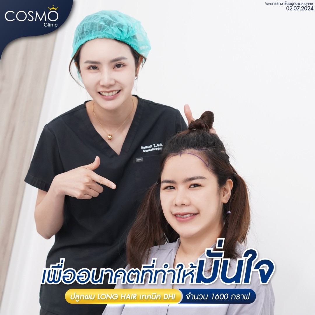 ปลูกผมยาว