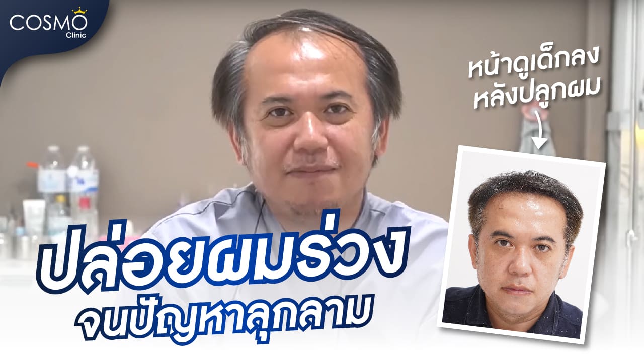 ปลูกผมคอสโมคลินิก