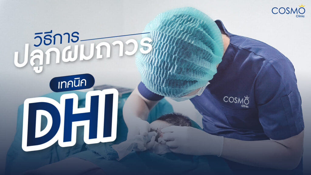 ปลูกผม-04