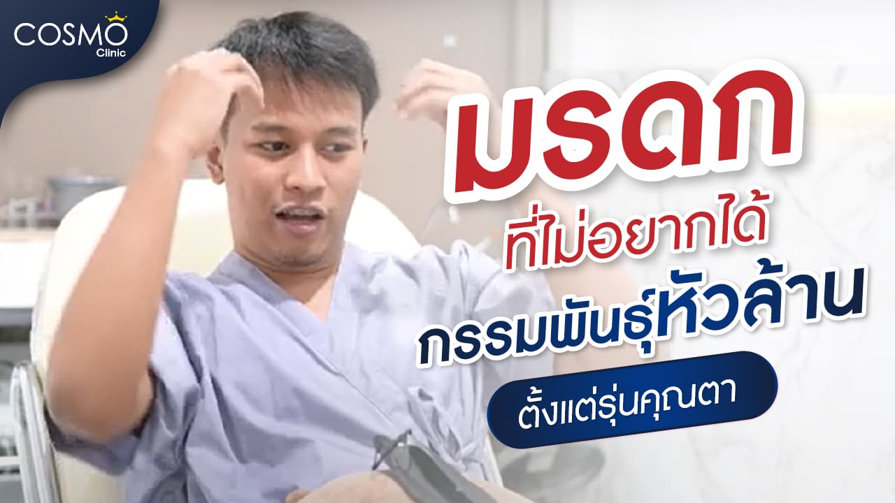 ปลูกผม-05