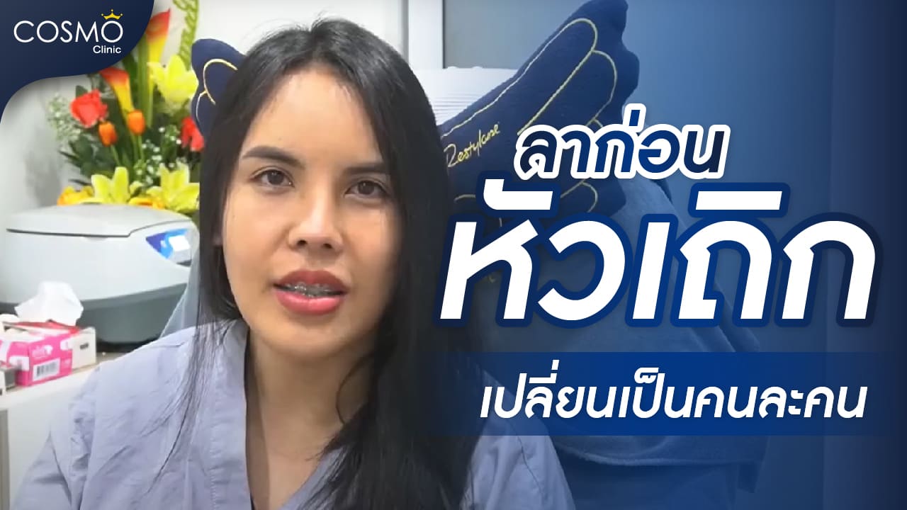 ปลูกผมหมอดิว