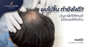 ผมไม่ขึ้น