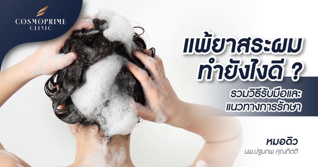 แพ้ยาสระผม