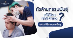 หัวล้านกรรมพันธุ์