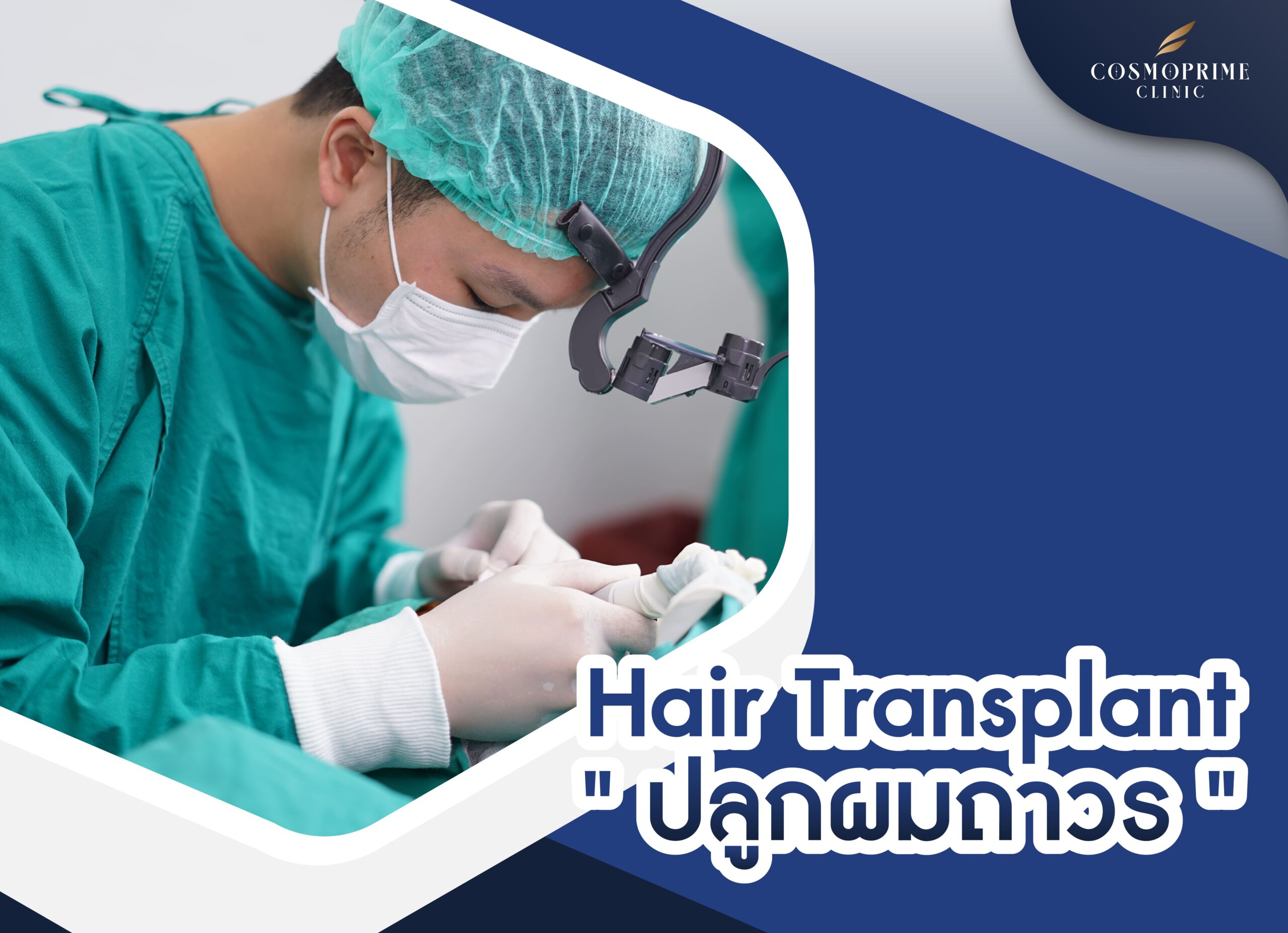 hair transplant