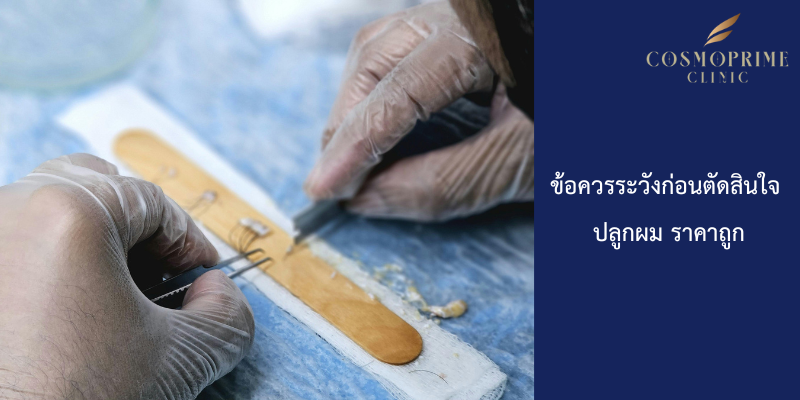 ข้อควรระวังก่อนตัดสินใจ ปลูกผม ราคาถูก