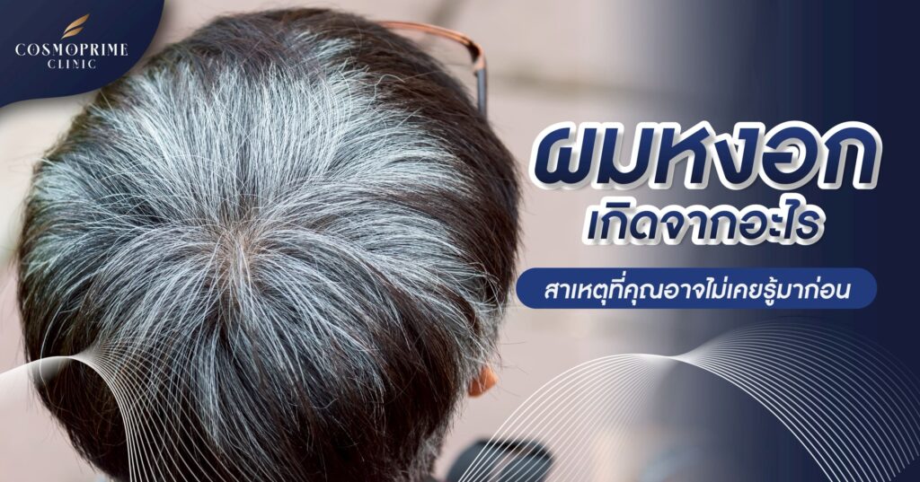 ผมหงอก