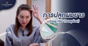 Long Hair Transplant