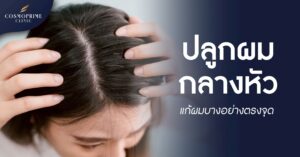 ปลูกผมกลางหัว