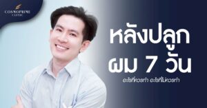 หลังปลูกผม 7 วัน