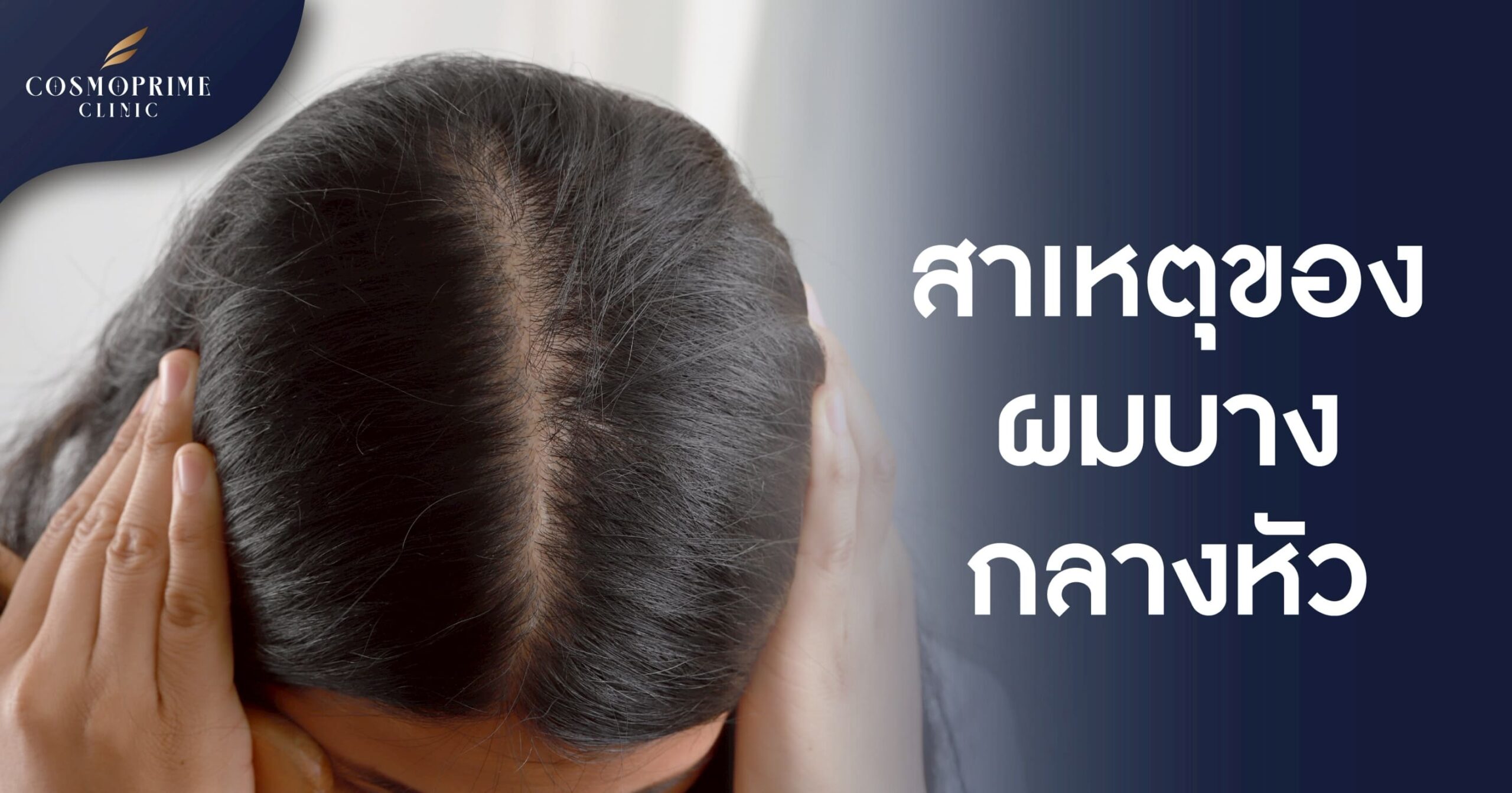 สาเหตุของ ผมบางกลางหัว