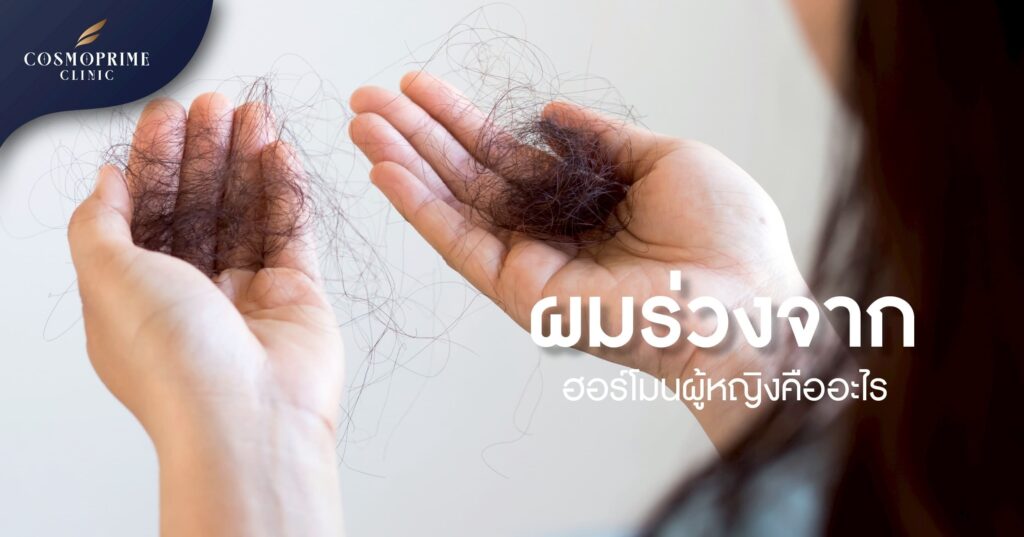 ผมร่วงจากฮอร์โมน ผู้หญิง
